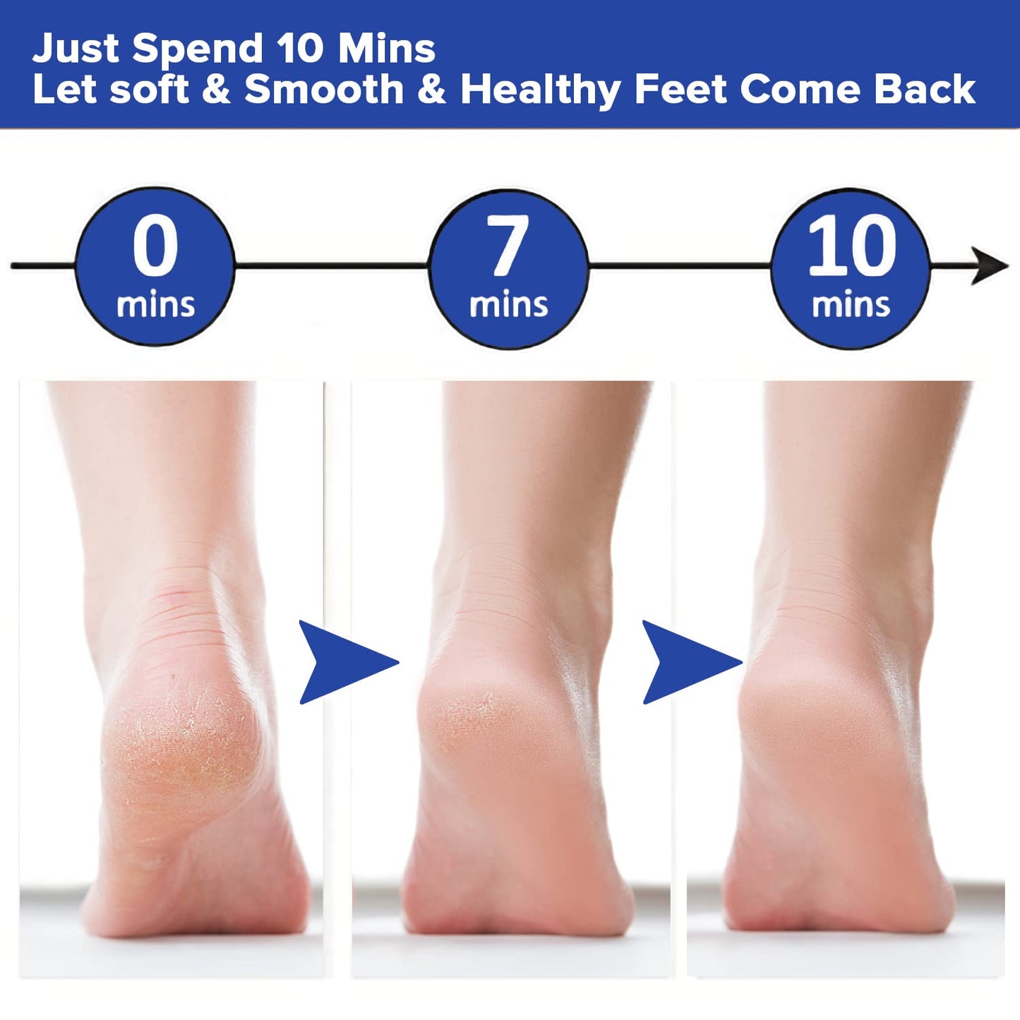 Electronic Cordless Pedicure Callus Dead Skin Remover Polishing Tool
