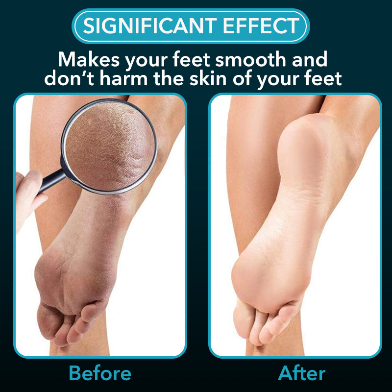 Electronic Cordless Pedicure Callus Dead Skin Remover Polishing Tool