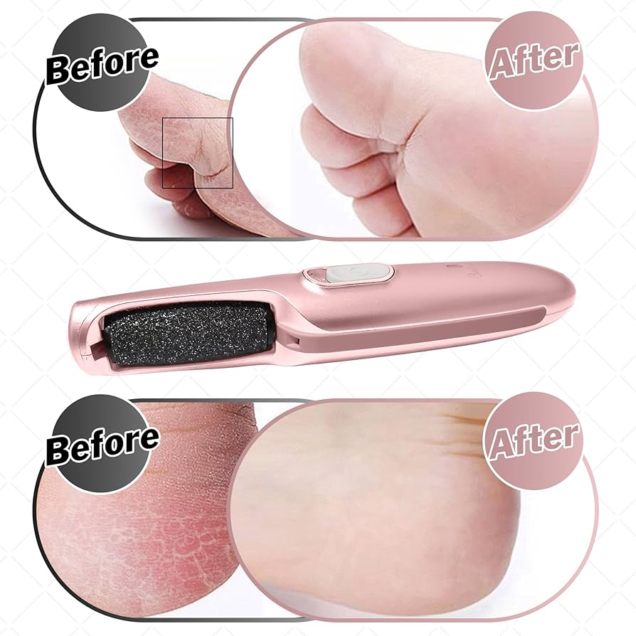 Electronic Cordless Pedicure Callus Dead Skin Remover Polishing Tool